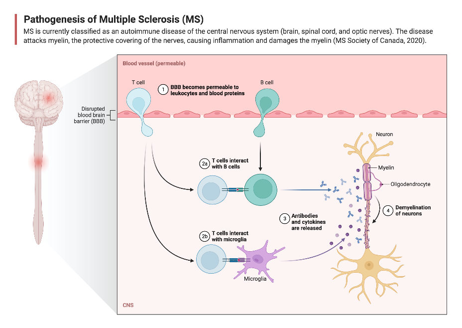 Biorender. Патогенез рассеянного склероза. Multiple Sclerosis.